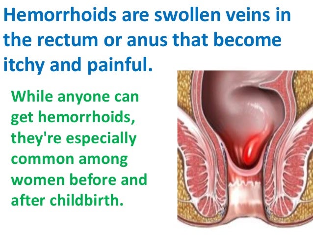 Swelling at the anus Mobile vibrator motor